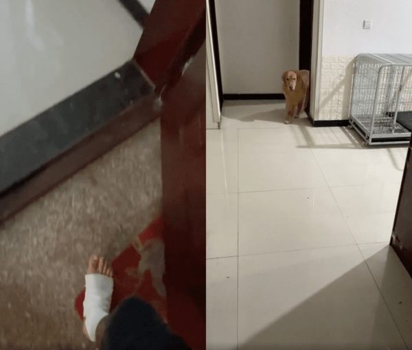 출처 : Reddit / 다리에 붕대를 감고 온 주인을 바라본 리트리버