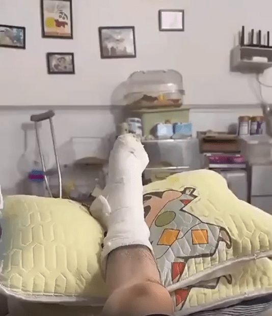 출처 : Reddit / 남자가 다리를 다쳐 기브스를 하고 큰 배게위에 다리를 올려둔 상태이다 카메라를 옆으로 돌리자 햄스터가 등을 대고 바닥에 누운채 한쪽다리를 들고있다